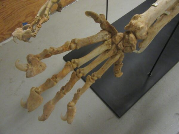 A skeleton of a hand is shown on display.